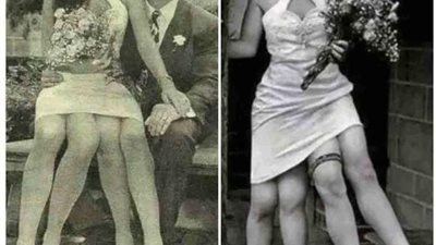 جوزيفين ميرتل ..المرأة ذات الأربع أرجل التى تزوجت وأنجبت 5 أبناء