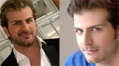 هاني حسين: نجم ستار أكاديمي يثير الجدل بعمليات التجميل… و”بـشاعة” ملامحه الجديدة موجة من السخرية!